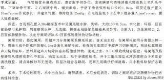 肠脂垂肿物图2