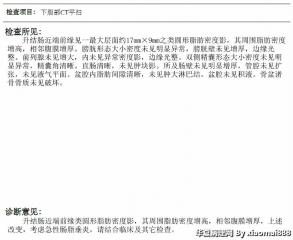 肠脂垂肿物图1