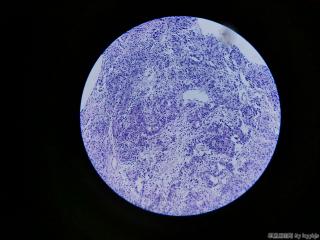 胃黏膜活检图5